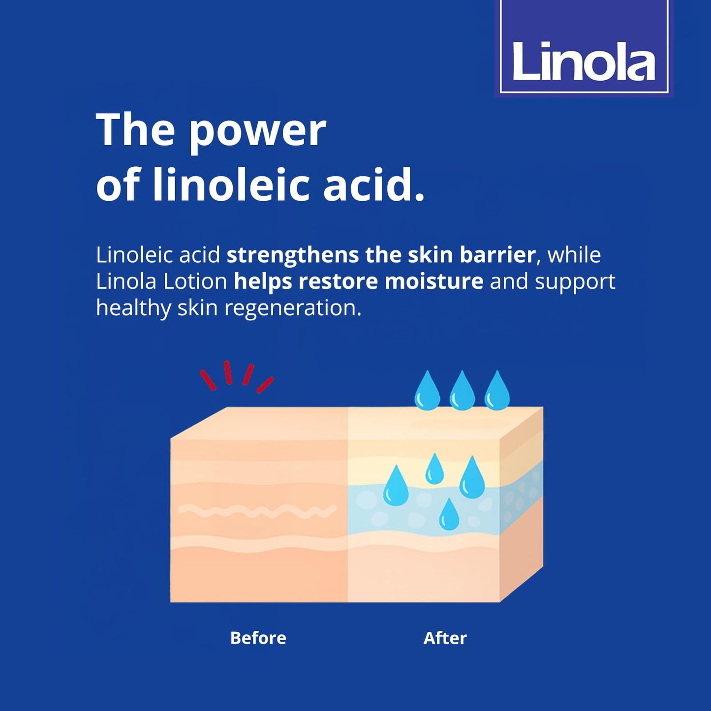 Linola Lotion - Body Lotion with Essential Linoleic Acids - for the Daily Care of Dry & Stressed Skin - Protects & Regenerates Dry Skin - Made in Germany - Vegan - 500 ml (16.9 Fl Oz)