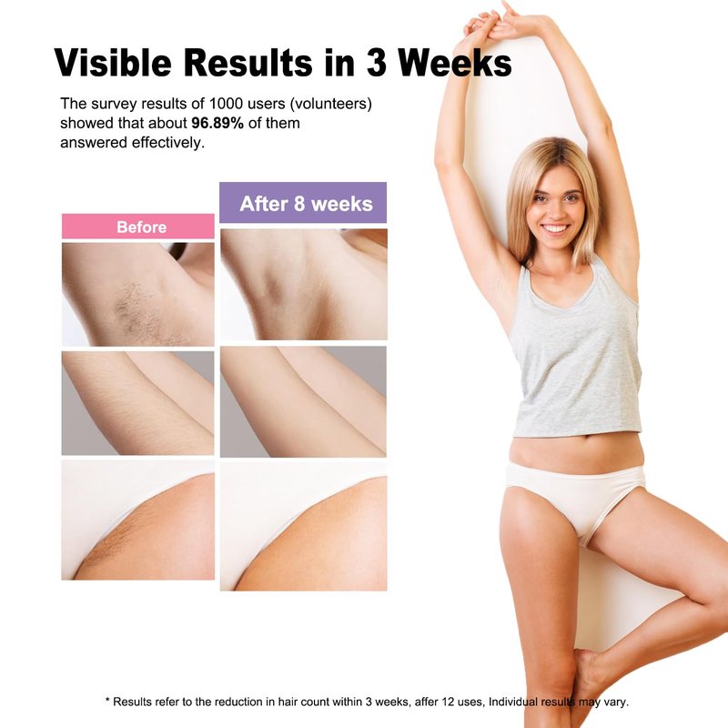 IPL Hair Removal Device, Model: AI08, for Facial Legs Arms Bikini Line