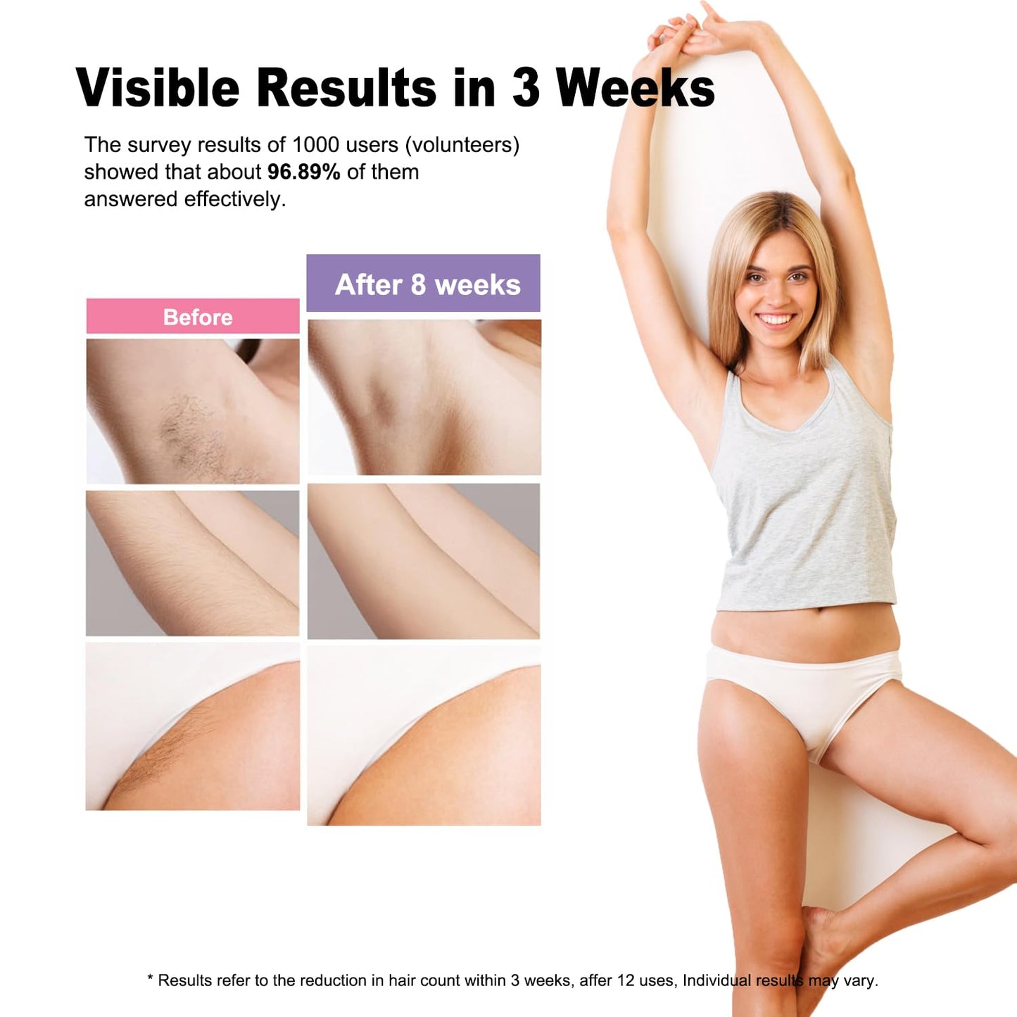 IPL Hair Removal Device, Model: AI08, for Facial Legs Arms Bikini Line