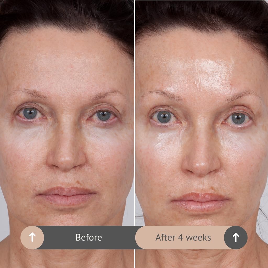 Consult Beaute VOLUMAGEN COLLAGEN EYE CREAM with Hyaluronic Acid, Hydrating, Skin Plumping - Targets Deep Under Eye Hollows, Visibly Smoothen Lines & Wrinkles 0.5 oz