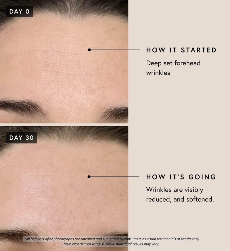 Regenerative Complex EGF Growth Factor Serum - Anti-Aging Cell Renewal & Wrinkle Reduction | 30ml