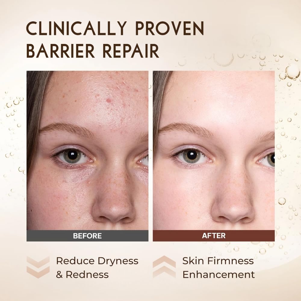 Barrier Enhancing Ampoule 50ml with Hydracell-QS, Triple Hyaluronic Acid, Panthenol & Ceramide – 100 Hours Deep Moisture, Strengthens Skin Barrier, Anti-Aging, Firming Treatment, Reduce Redness