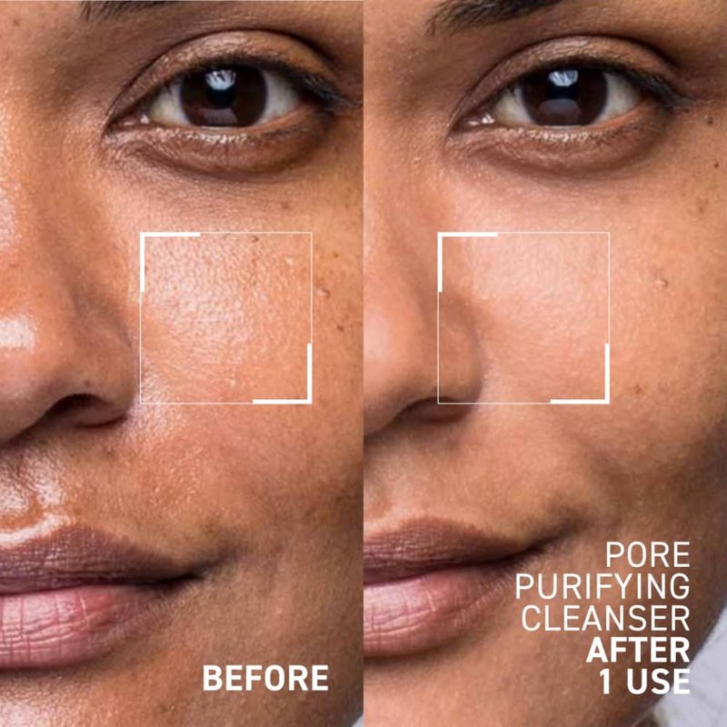 Dr. Brandt Pores No More, Pore Purifying Cleanser - Non-Drying Gel - Helps to Minimize the Appearance of Pores & Dissolves Impurities - 4.2 fl oz