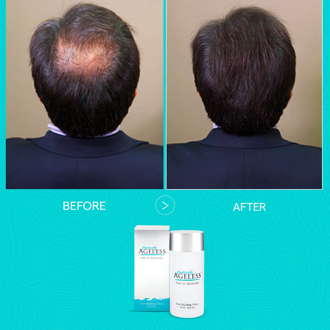 Instantly Ageless® Hair in Seconds™ Hair Building Fibers – Hair Thickening Fibers for Thinning Hair & Hair Loss for Fuller-Look - 0.83 oz (23g) - Light Brown