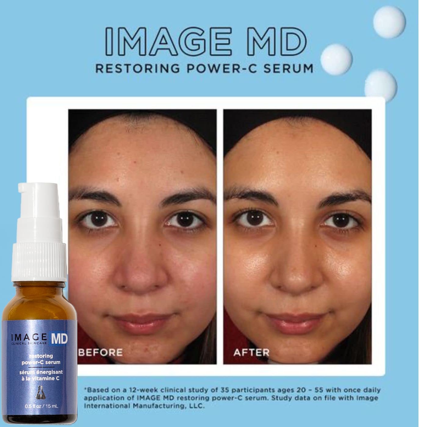 IMAGE Skincare, IMAGE MD Restoring Power-C Serum, 20% Vitamin C, Ferulic Acid Facial Serum to Reduce Pigmentation, Firm, Brighten Skin