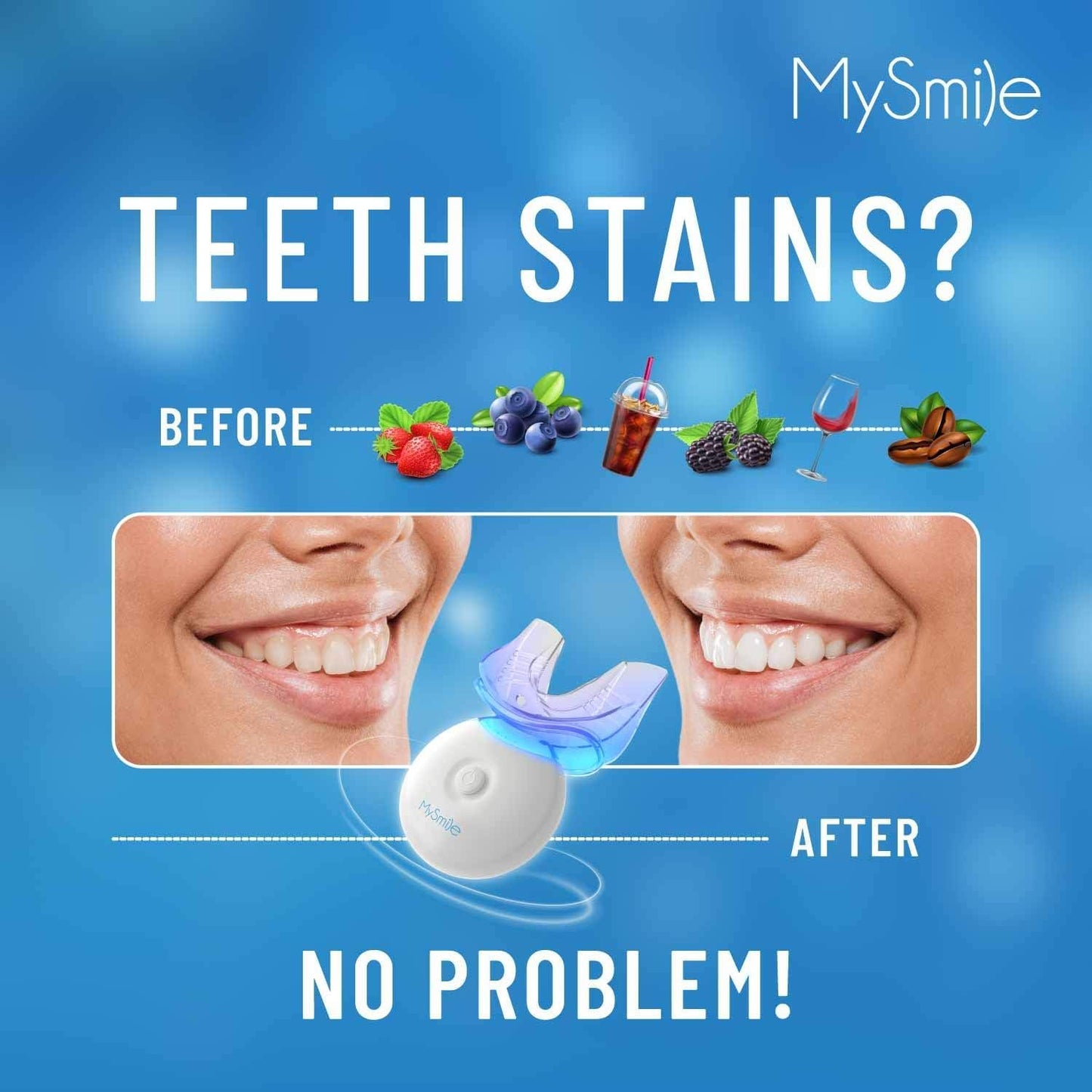 MySmile Teeth Whitening Kit with LED Light, 10 Min Fast Teeth Whitener with 3 x 35% Carbamide Peroxide Whitening Gel, Helps to Remove Stains from Coffee, Smoking, Wines, Soda, Food