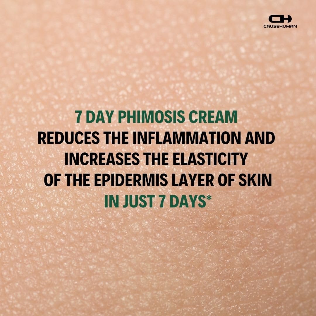 Cause Human 7-Day Phimosis Cream | Steroid-Free Treatment for Fast Relief at Home | Visible Results in 7 Days* | 3.16 fl oz (90g) | No Irritation | No Steroids (7 Day Phimosis Relief Cream)