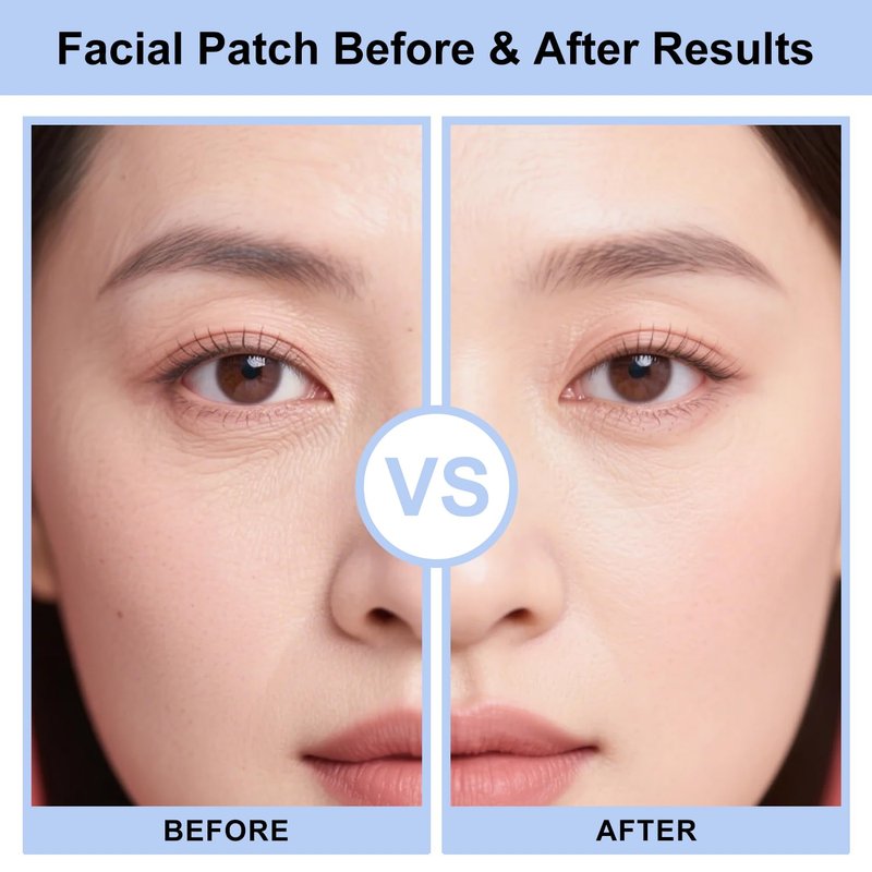 ARMINACO Wrinkle Patches for Forehead & Smile Lines, Overnight Anti-Wrinkle Facial Pads with Hyaluronic Acid, Niacinamide & Vitamin E – Hydrating & Smoothing Skin Care, 36pcs