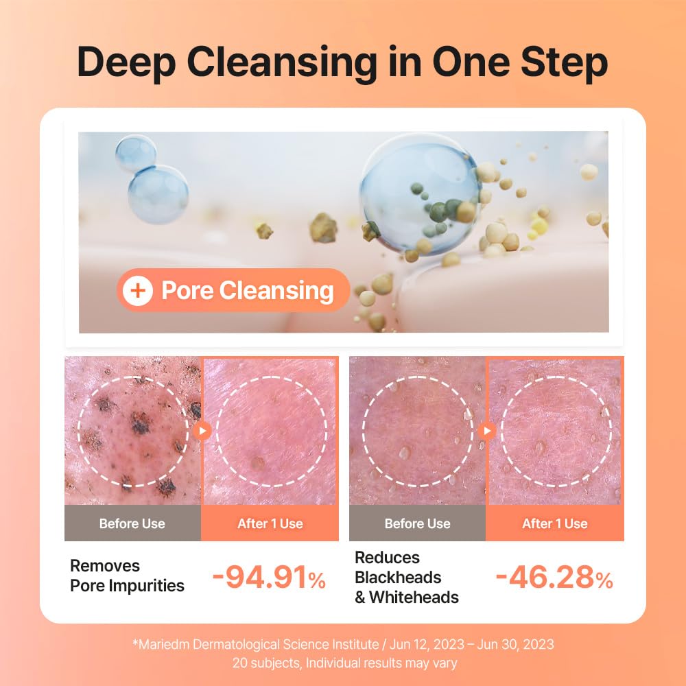 UIQ Biome Barrier Collagen Firming Cleansing Balm, Deep Pore & Waterproof Makeup Remover, Microbiome Skincare, 100ml / 3.38 fl.oz