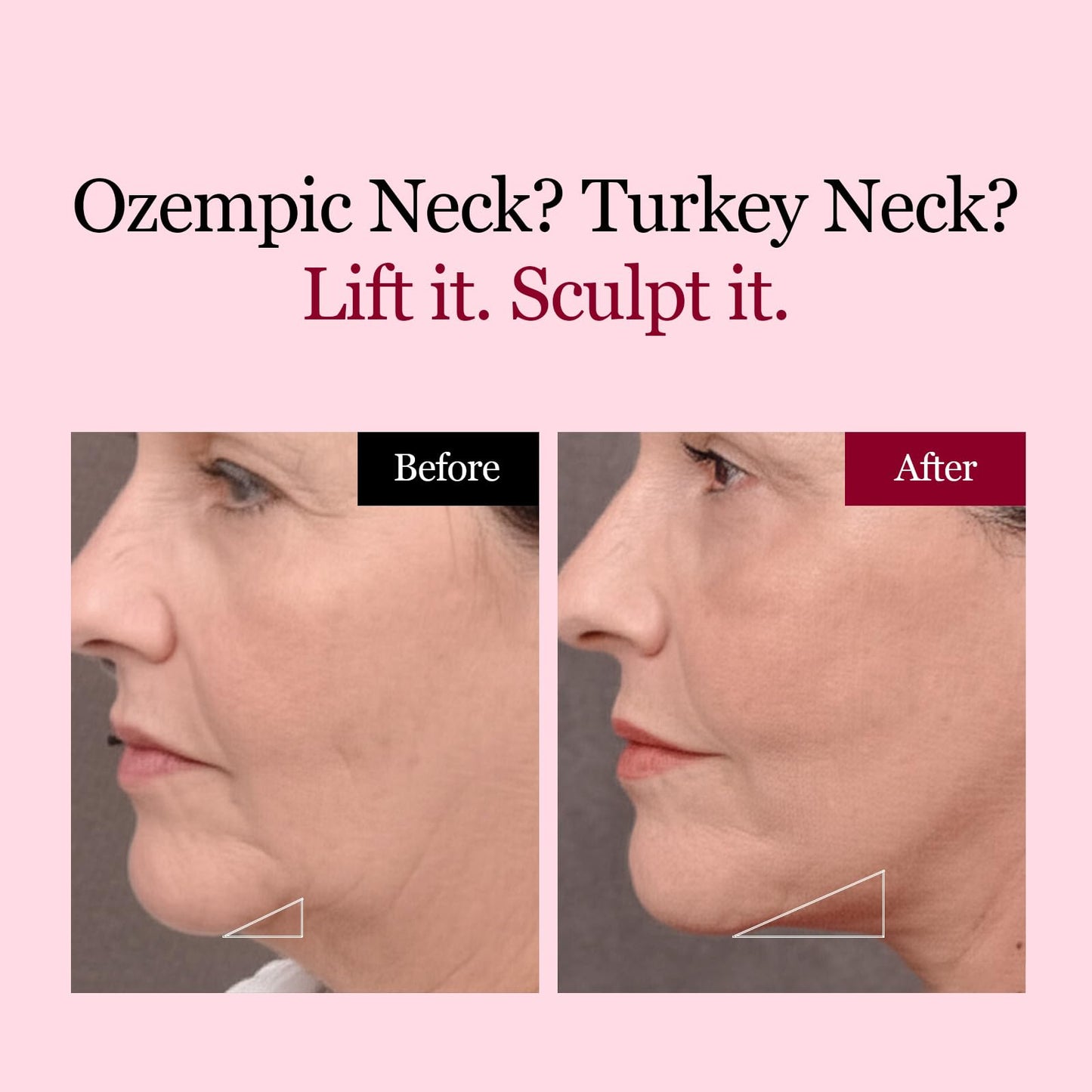 ROUND LAB Camellia Deep Collagen V Lifting Gel Mask 14ea | Double-chin Turkey Neck Instant Face Lifting Mask, Cooling and Depuffing Face Toning Belt, Firming Sagging Skin, Korean Skin Care, 10g/0.35oz