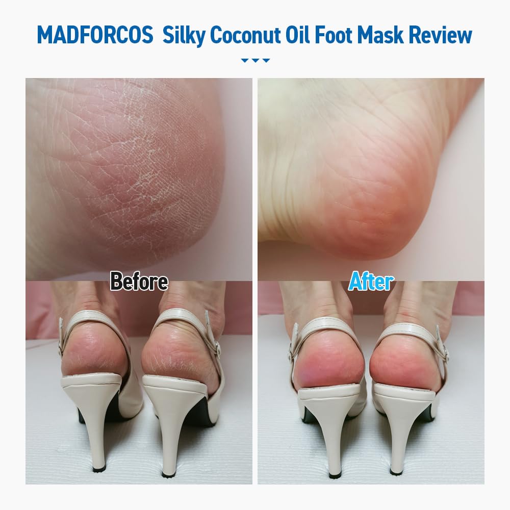 MADFORCOS Moisturizing Foot Mask Socks Silky Coconut Oil Booties for Dry, Cracked Feet & Heels | 5 Pairs