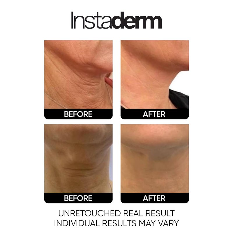 Neck & Décolleté Firming Cream – Anti-Aging Moisturizer for the Appearance of Crepey Skin, Wrinkles, Vertical Lines & Sagging - Improve Skin Tone, Texture & Hydration for Smoother-Looking Skin.