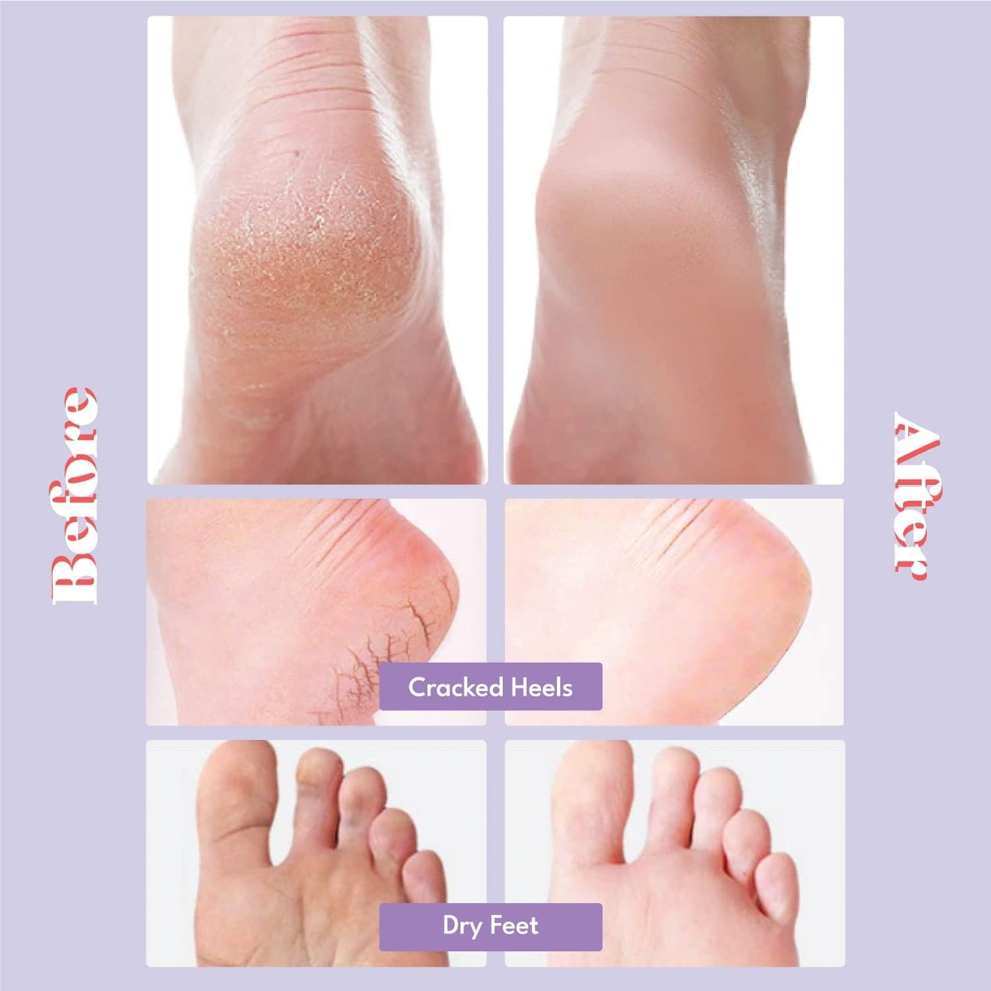 Extra Silky Foot Mask - Moisturizing Treatment Socks with Guerande Salt & Almond Oil | 5 Pairs for Dry Feet & Cracked Heels