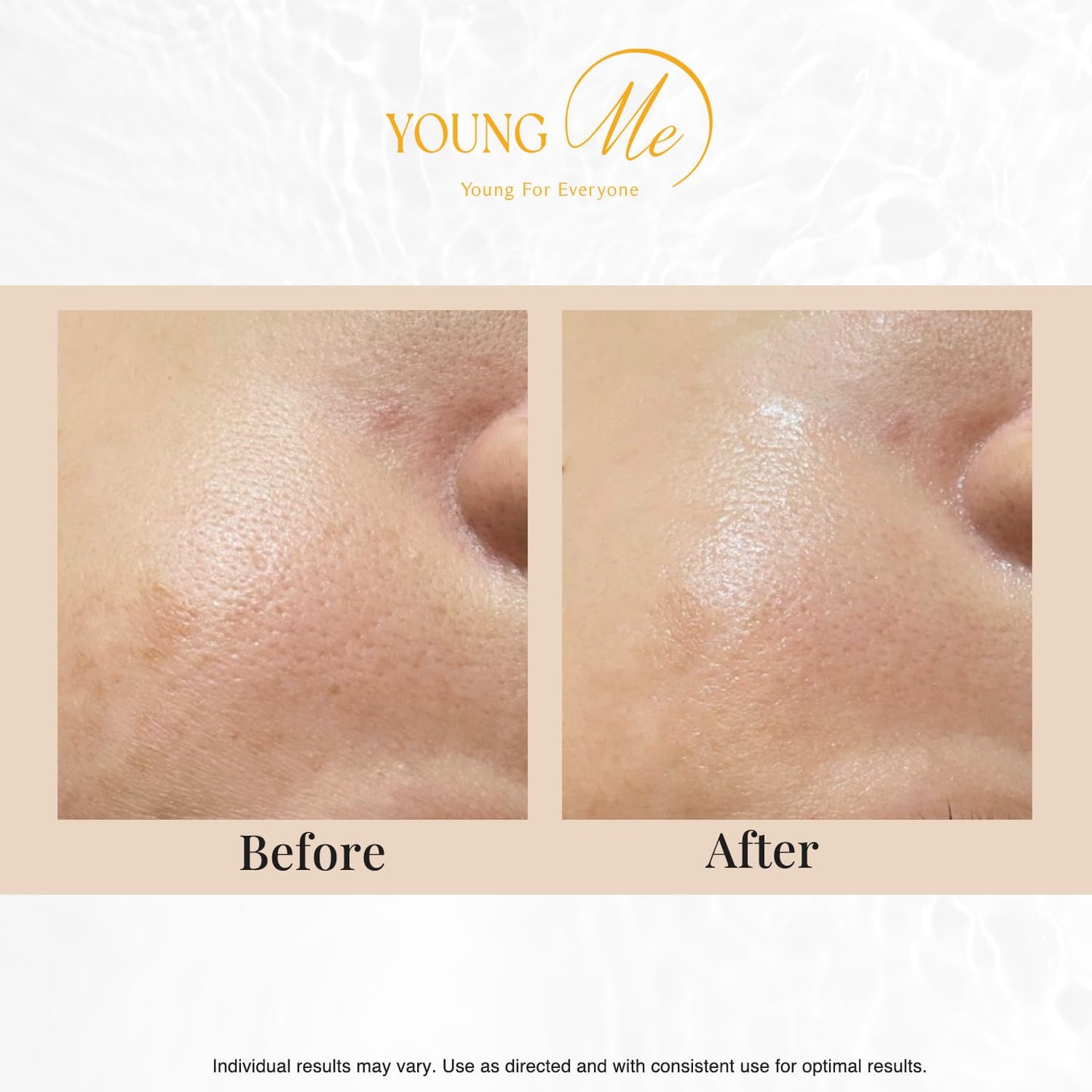 YoungMe Radiant Glamour Korean Sheet Mask – Rejuvenating & Hypoallergenic Facial Mask for All Skin Types | 25g x 6 Sheets