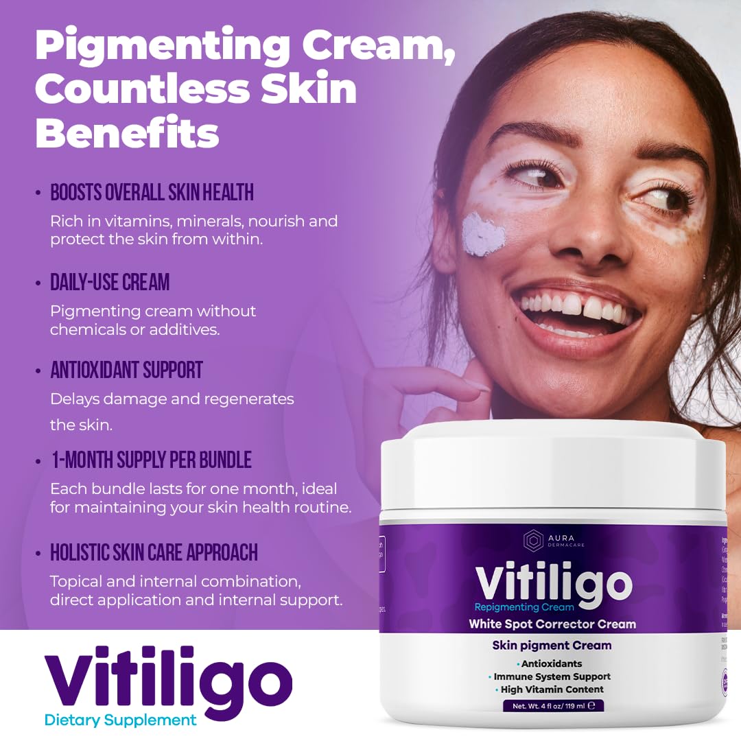 Vitiligo Cream for White Spots (4oz) - Repigmenting Cream with Polypodium Leucotomos and Melanocyte Support - Evens Skin Tone and Reduces Discoloration by Aura Dermacare