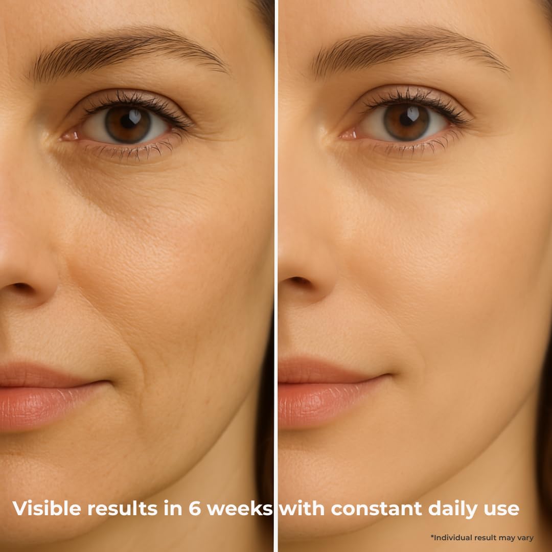 INSANE GLOW Anti-Aging Eye & Lip Contour Cream for Sensitive Skin – Puffy Eyes and Dark Circles with Hyaluronic Acid Spheres & Tamanu Oil – Depuffs, Firms & Smooths Fine Lines – Dermatologist Tested