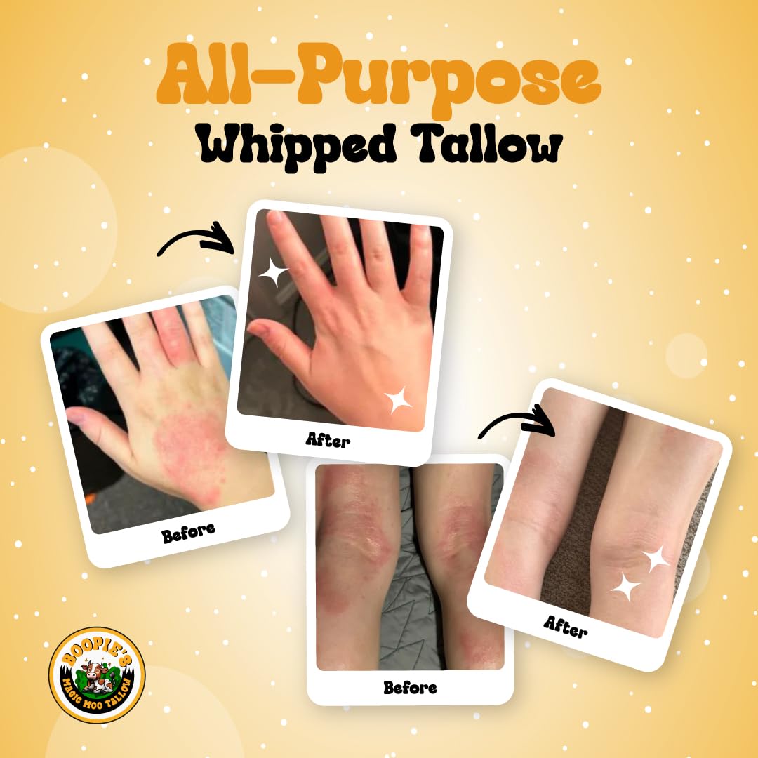 Magic Moo All Purpose Whipped Beef Tallow Skincare for Acne, Eczema, Dry Skin, Moisturizer, Stretch Marks & Hydration. Suet Tallow for Face with Organic Emu Oil. Contains All Organic Ingredients, 4oz