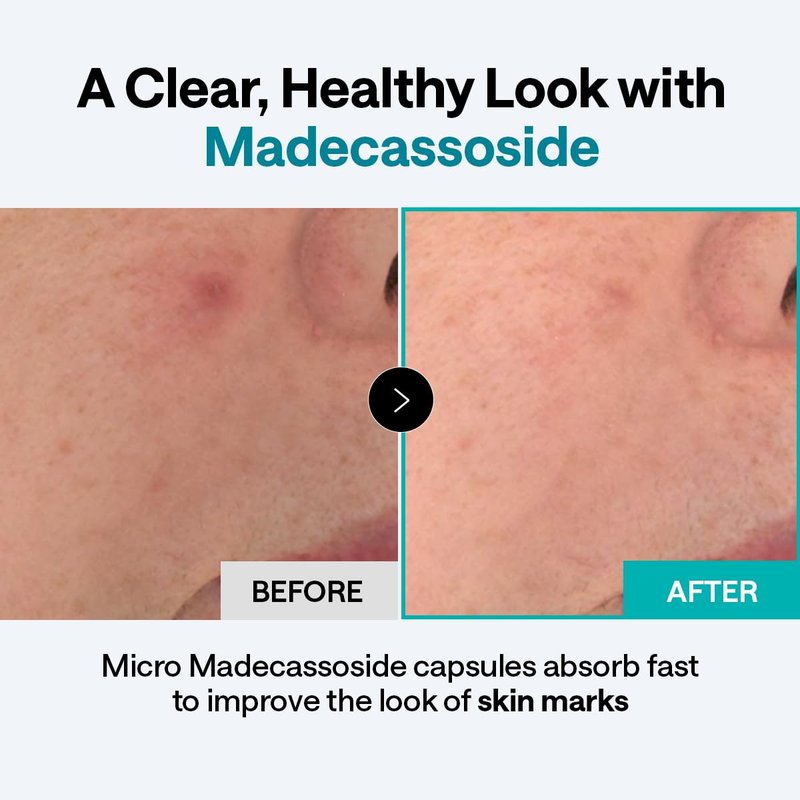 Mediheal Derma Cream [Madecassoside] - Soothing Korean Face Moisturizer with Niacinamide, Squalane & Ceramide - Barrier Repair, Dark Spot & Acne Mark Care for Sensitive Skin (1.69 fl oz)