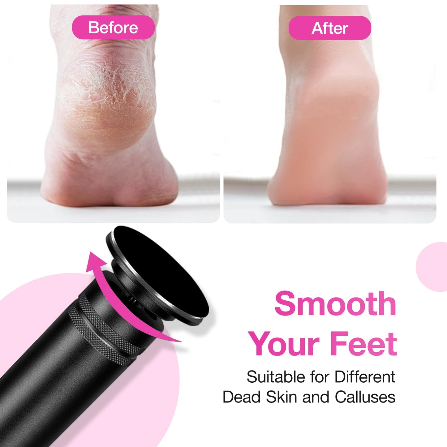 Hocent Upgrade 1200RPM Electric Callus Remover for Feet, Powerful Electric Foot File with 60 Sandpaper Discs, Adjustable Speed, Plug-in Pedicure Tool for Cracked Heels & Dead Skin, Black