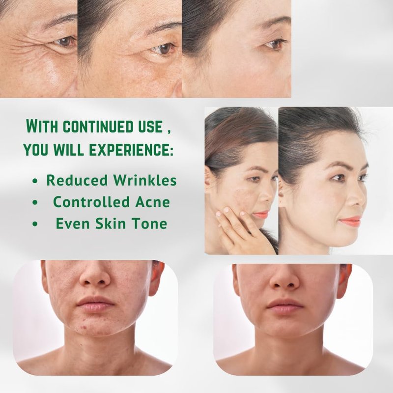 Aloe Vera Clay Mask for Face - Moisturizing Deep Pore Cleanser with Vitamin C | Eczema, Oily & Dry Skin Care