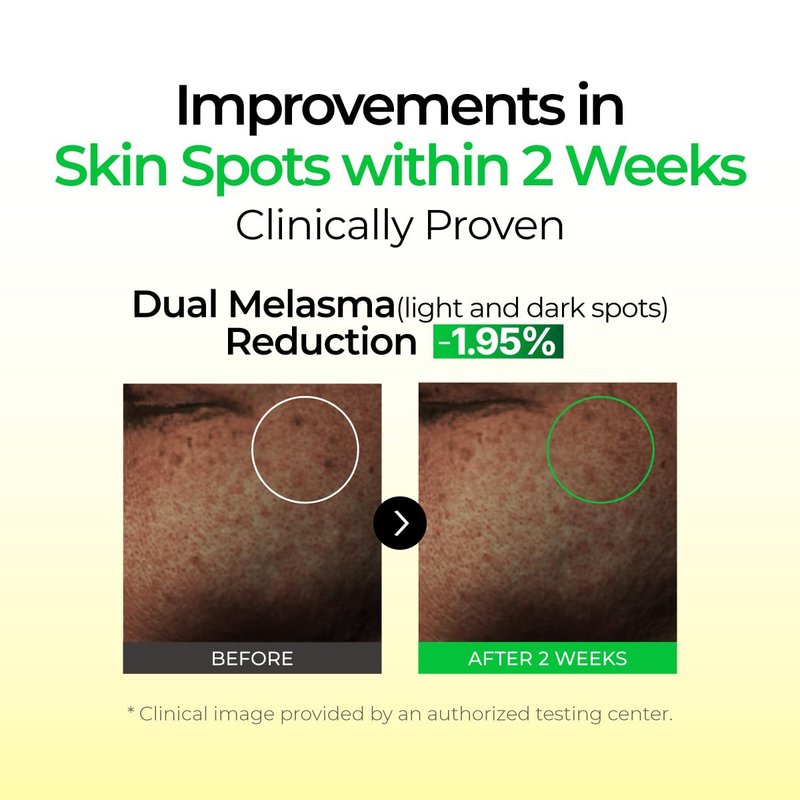 IZEZE Lemon CNA Vita Serum - Dark Spot Correcting Niacinamide & Vitamin C | 1.01 fl. oz, Brightening Korean Skincare