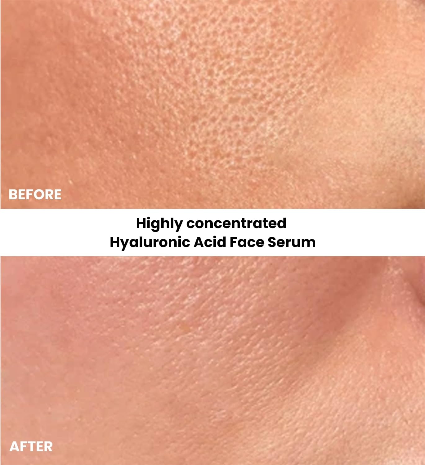 Kleem Hydrating Hyaluronic Acid Serum for Face – Deep Hydration & Skin Barrier Support - Anti Aging Face Serum with Antioxidants & Aloe Vera - Plumped, Hydrated & Softer Skin - 1 Fl Oz (30ml)
