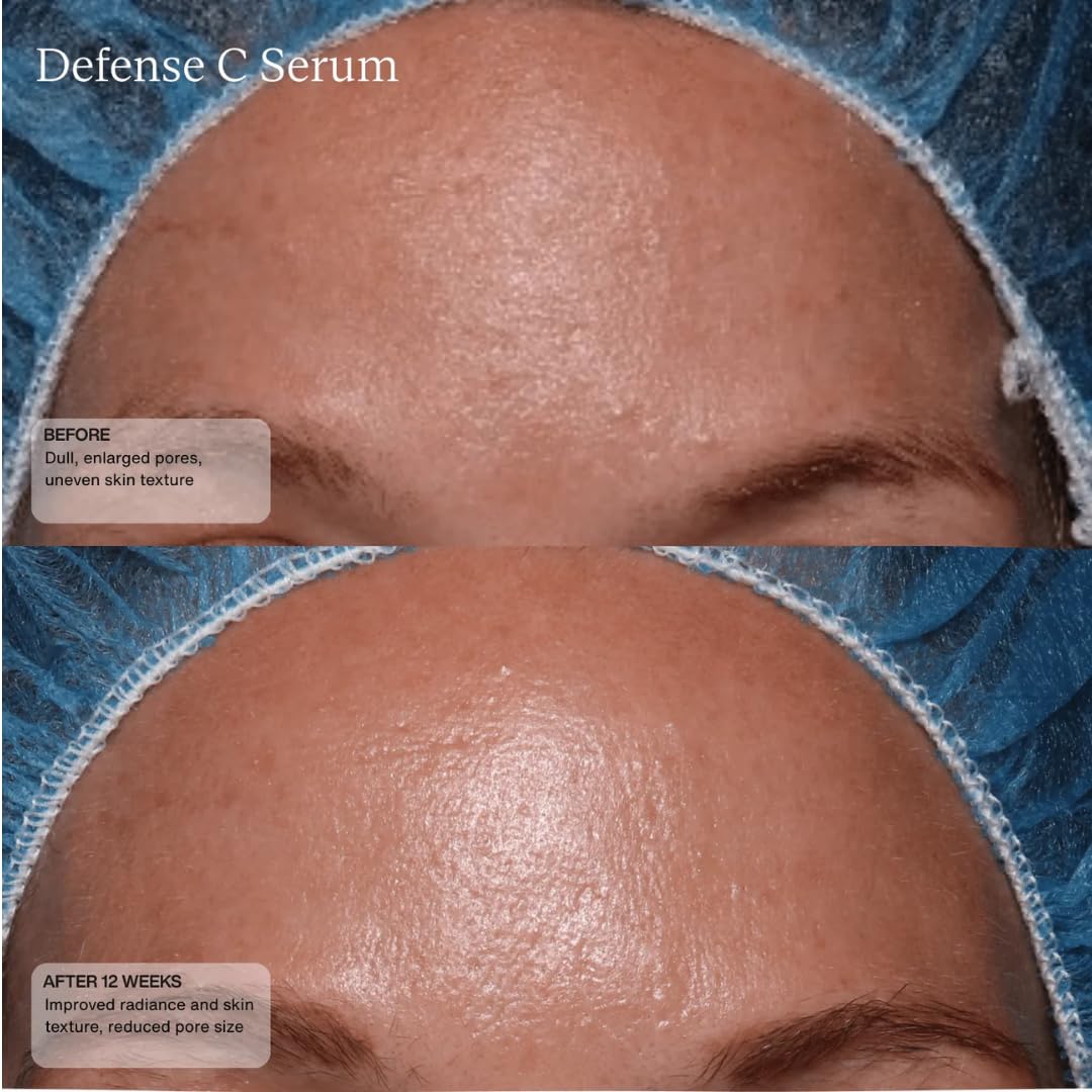 Senté Defense C Serum | Vitamin C Serum for Sensitive Skin | Helps Improve Tone, Texture & Radiance | Antioxidant-Rich Formula | 1 Fl Oz