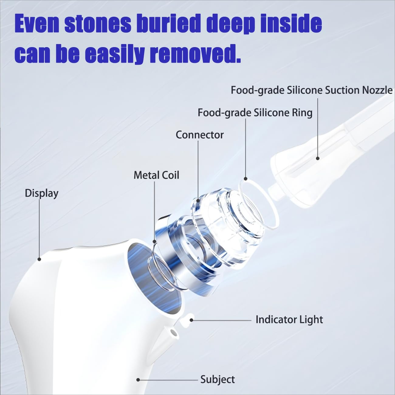 Electric Tonsil Stone Remover – High-Precision & Painless Cleaning, Food-Grade Suction Tool with LED Light, 12 Attachments & Vacuum Cleaning for Tonsil Stones, Bad Breath Relief