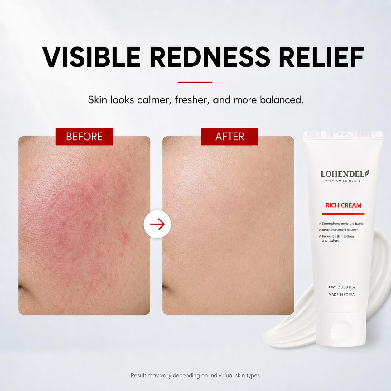 LOHENDEL Rich Cream - Soothe Irritated Skin, Intense Moisturizer