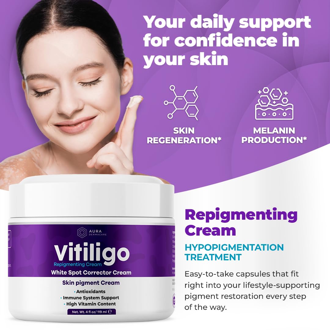 Vitiligo Cream for White Spots (4oz) - Repigmenting Cream with Polypodium Leucotomos and Melanocyte Support - Evens Skin Tone and Reduces Discoloration by Aura Dermacare