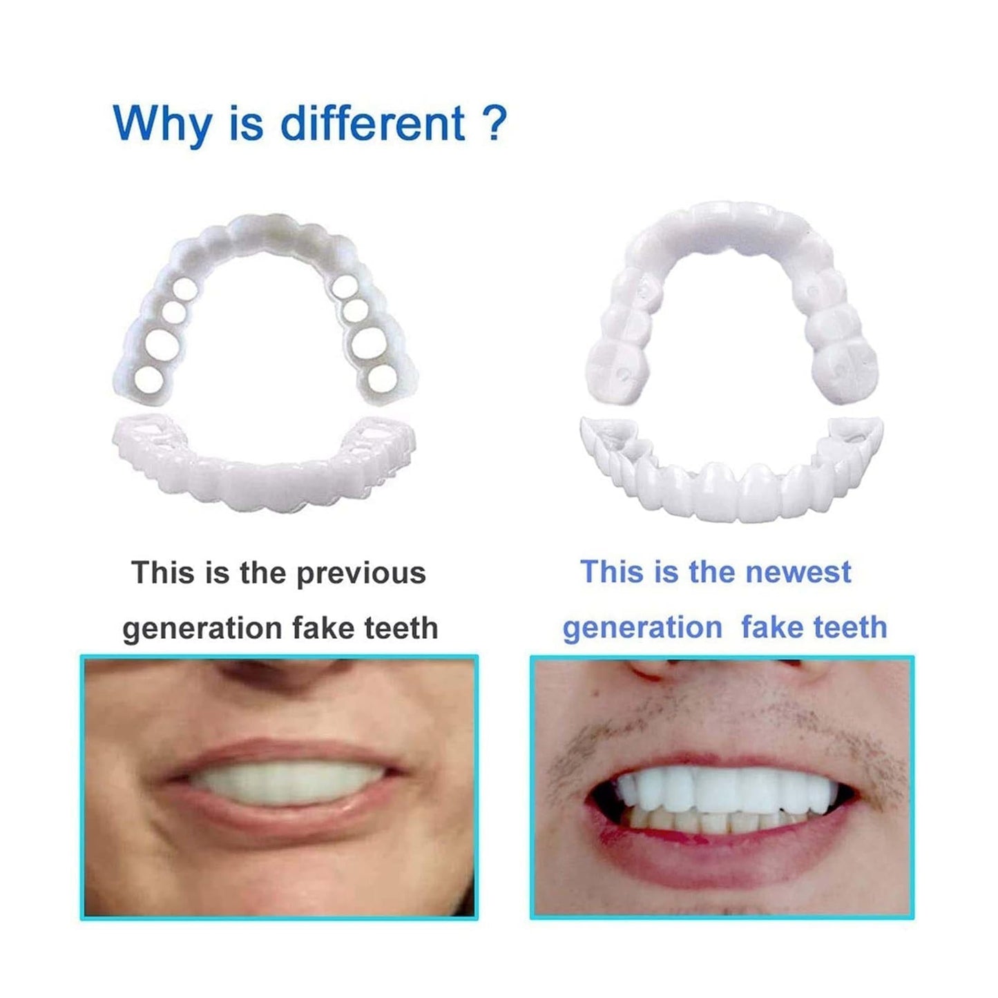 2 Pairs, Temporarily Restore Confident Smiling, Adjustable for Men and Women, Top and Bottom (1)