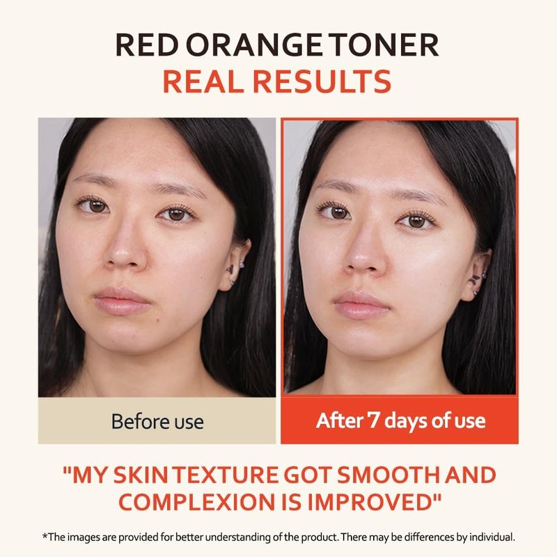 Niacinamide Toner - Tone Up Vitalizing Facial Essence | Smooth Skin Texture, 150ml