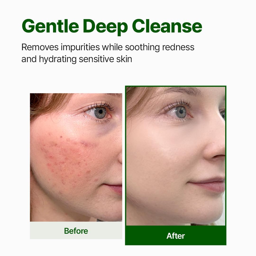 NACIFIC Cica PDRN Gel Cleanser 6.76 fl oz 200ml, Centella Asiatica, Low pH Deep Pore Cleanser for Sensitive Skin, Soothing, Purifying Korean Face Wash