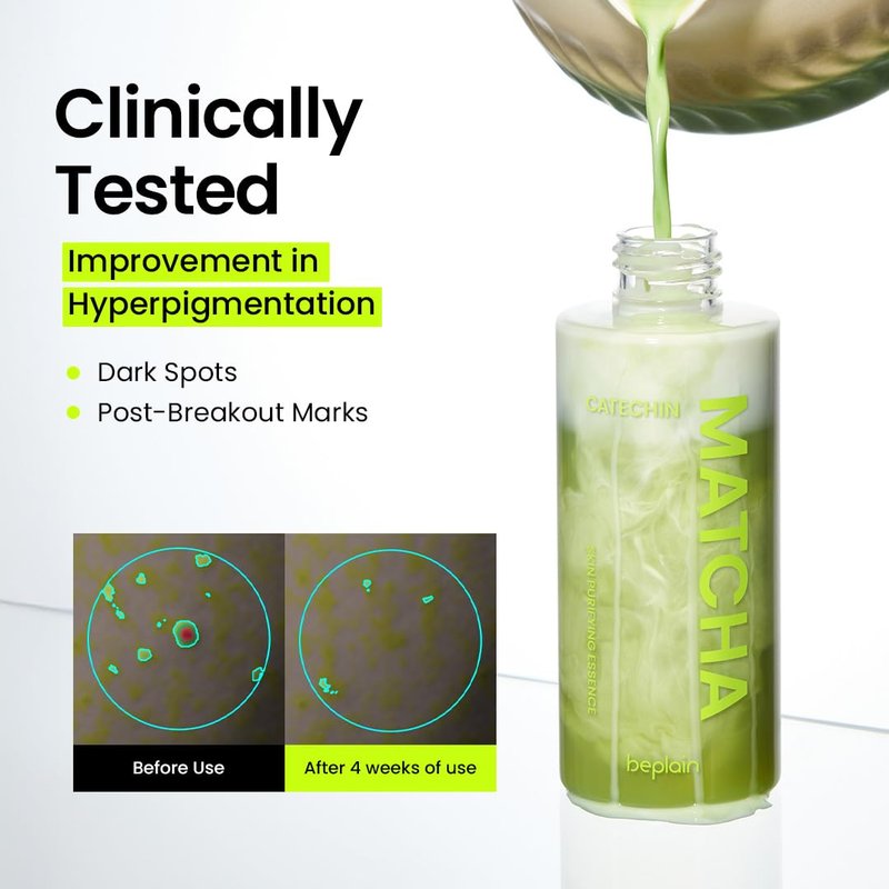beplain Matcha Catechin Skin Purifying Essence | 5% Niacinamide Facial Essence for Uneven Tone & Barrier Care | Antioxidant Korean Skincare | 5.07 fl.oz