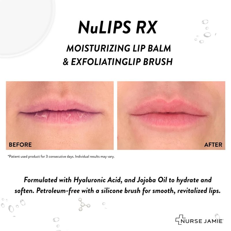 Nurse Jamie NuLipsRX Lip Treatment System – Exfoliating Silicone Brush & Hydrating Balm with Hyaluronic Acid