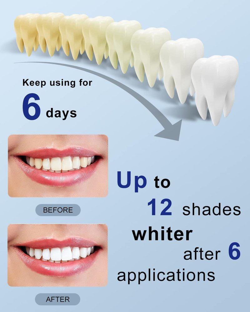 MySmile Teeth Whitening Strips Kit - 14 Treatments with LED Light | Fast, Non-Sensitive Teeth Whitener for Deep Stains
