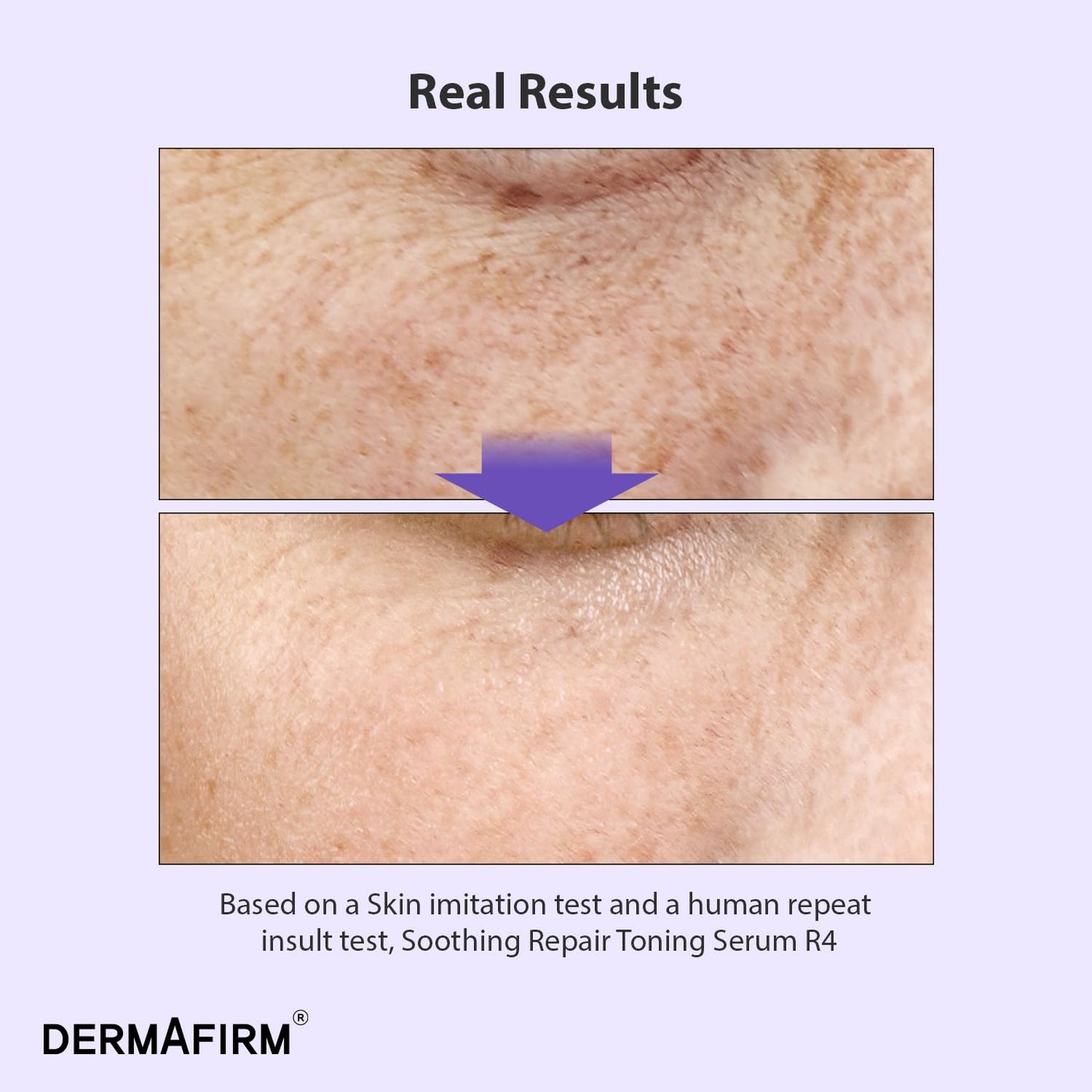 Bakuchiol Retinol Serum - Korean Skin Care with Niacinamide & Peptides | Soothing Toning Serum for Sensitive Skin