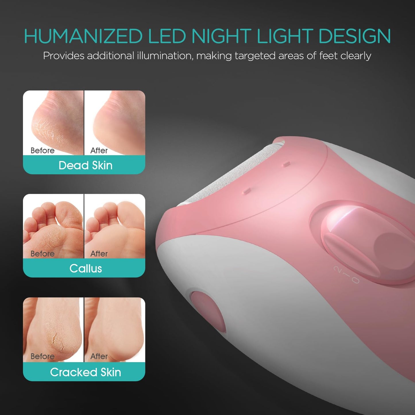 VOGOE Electric Callus Remover for Feet, Rechargeable Foot File Pedicure Tools with 3 Rollers & 2 Speeds, Professional Feet Scrubber Remover Foot Care for Calluses, Cracked Dry Dead Skin CR310 Pink