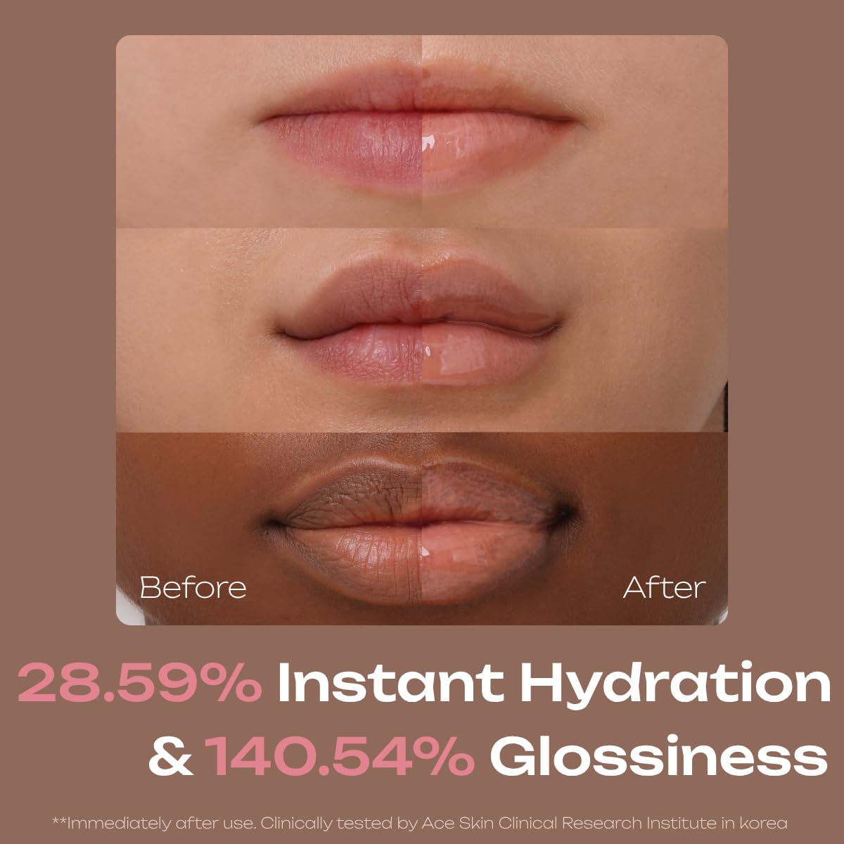 Losy Kim PDRN Tinted Lip Serum – High Gloss Ultra Hydrating Natural Glow, Non-Sticky Volumizing Color Glaze with Long-Lasting Shine, Nourishing Moisturizing Repair for Chapped Lips (0.34 oz)