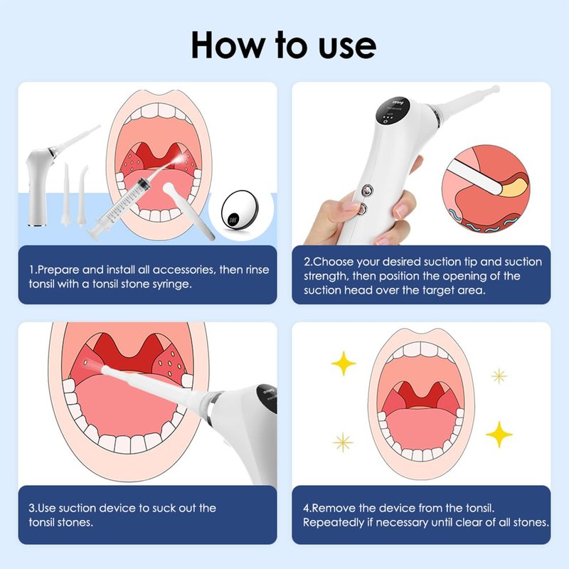 Electric Tonsil Stone Remover – High-Precision & Painless Cleaning, Food-Grade Suction Tool with LED Light, 12 Attachments & Vacuum Cleaning for Tonsil Stones, Bad Breath Relief