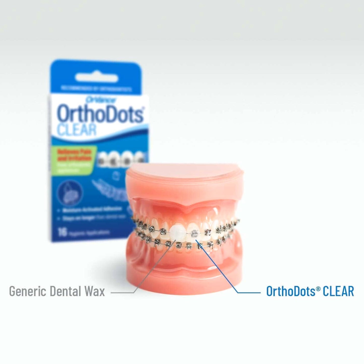 OrthoDots CLEAR – 24-Hour Protection | Sticks Better than Dental Wax | Moisture Activated Braces Wax Alternative for Pain Caused by Braces, Clear Aligner Trays, and Other Orthodontic Appliances