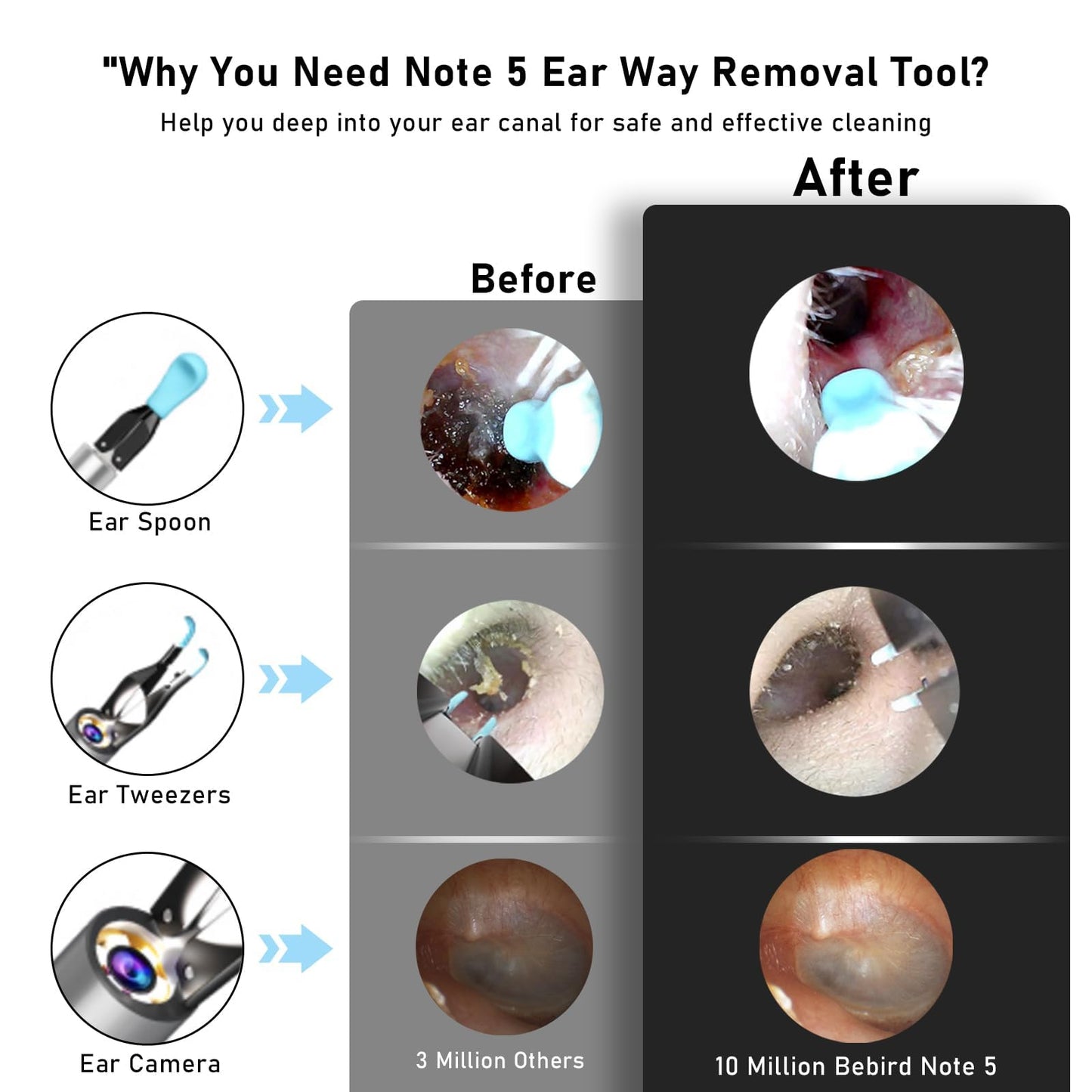 KWYBOW Note5 Ear Wax Tweezers with Camera, 10MP Ear Cleaner Camera Otoscope with Light,Real-time Remote Video with Ear Pick & Tweezers,12 Pcs Ear Scoops for Whole Family