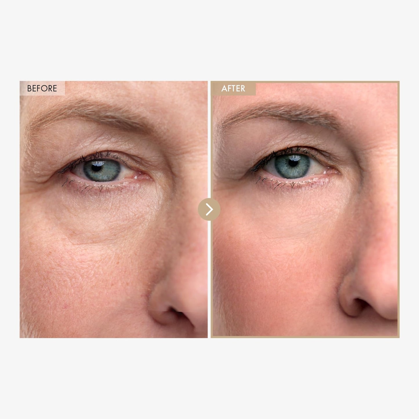TOSOWOONG Carnosine Lifting Serum for Wrinkle Care & Firming, Fine Lines
