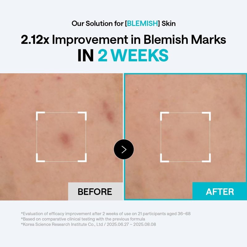 Mediheal Toner Pads | Madecassoside Blemish Care with Centella Asiatica - 100 Count for Even Skin Tone & Deep Hydration