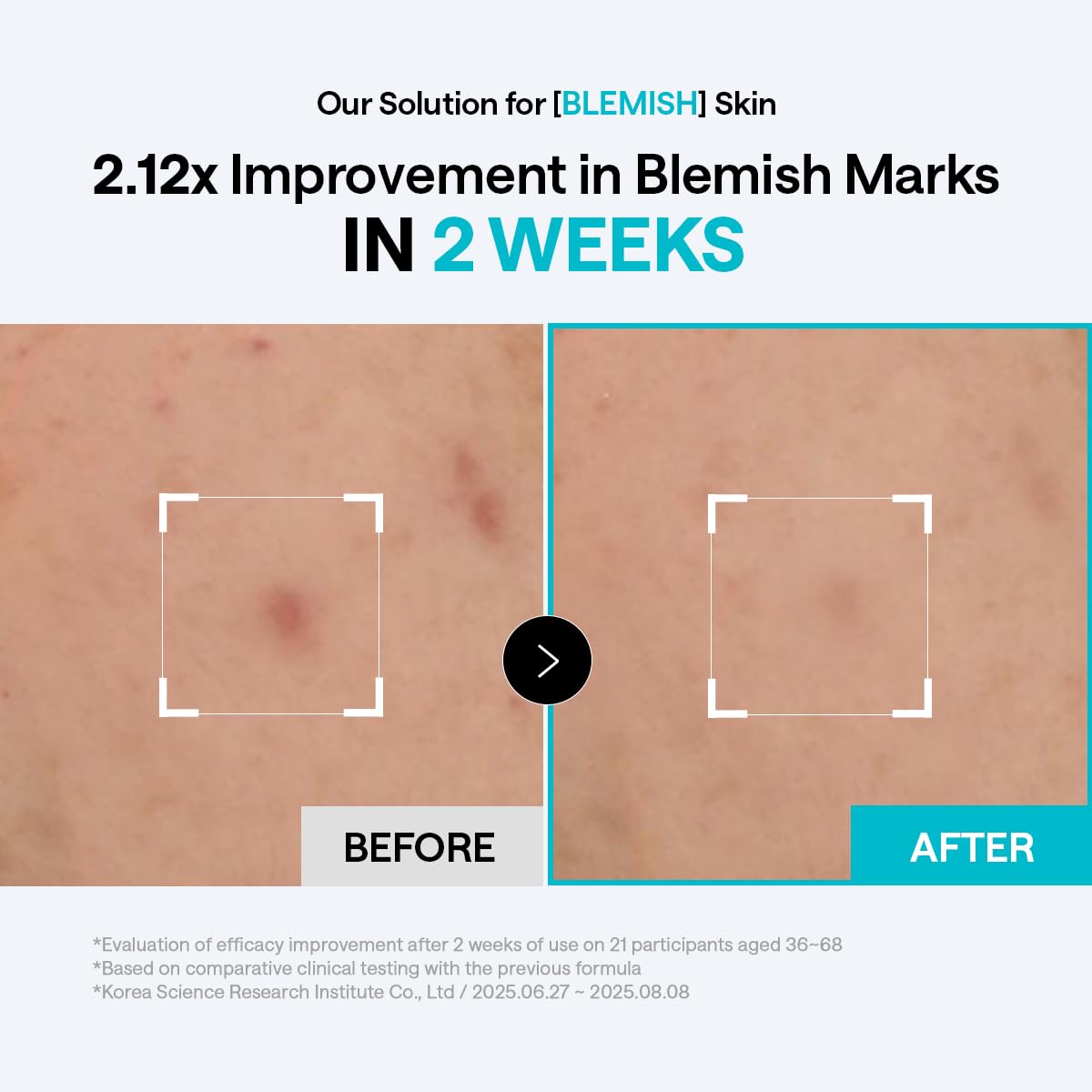 MEDIHEAL Madecassoside Blemish Repair Skincare Bundle – Toner Pads (100ct) + Repair Serum + Derma Cream | Centella Asiatica Tone Care, Hydration & Skin Barrier Support