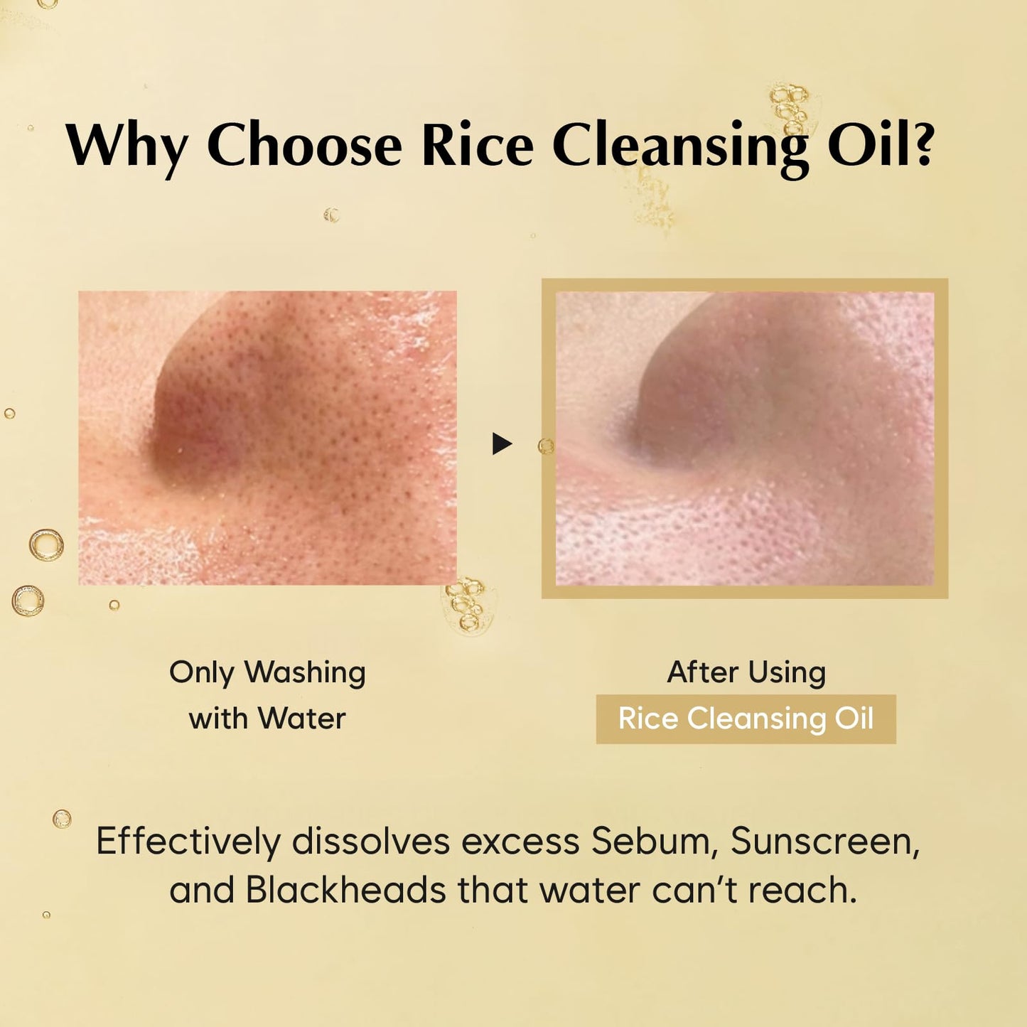 MIDHA RICE CLEANSING OIL 5.07fl.oz/150ml, Gentle Makeup Remover, Hydrating, Lightweight, Plant-Based, Moisturising, First-Step Cleanser, Balanced Skin with Residue-Free, Sebum Care Formula