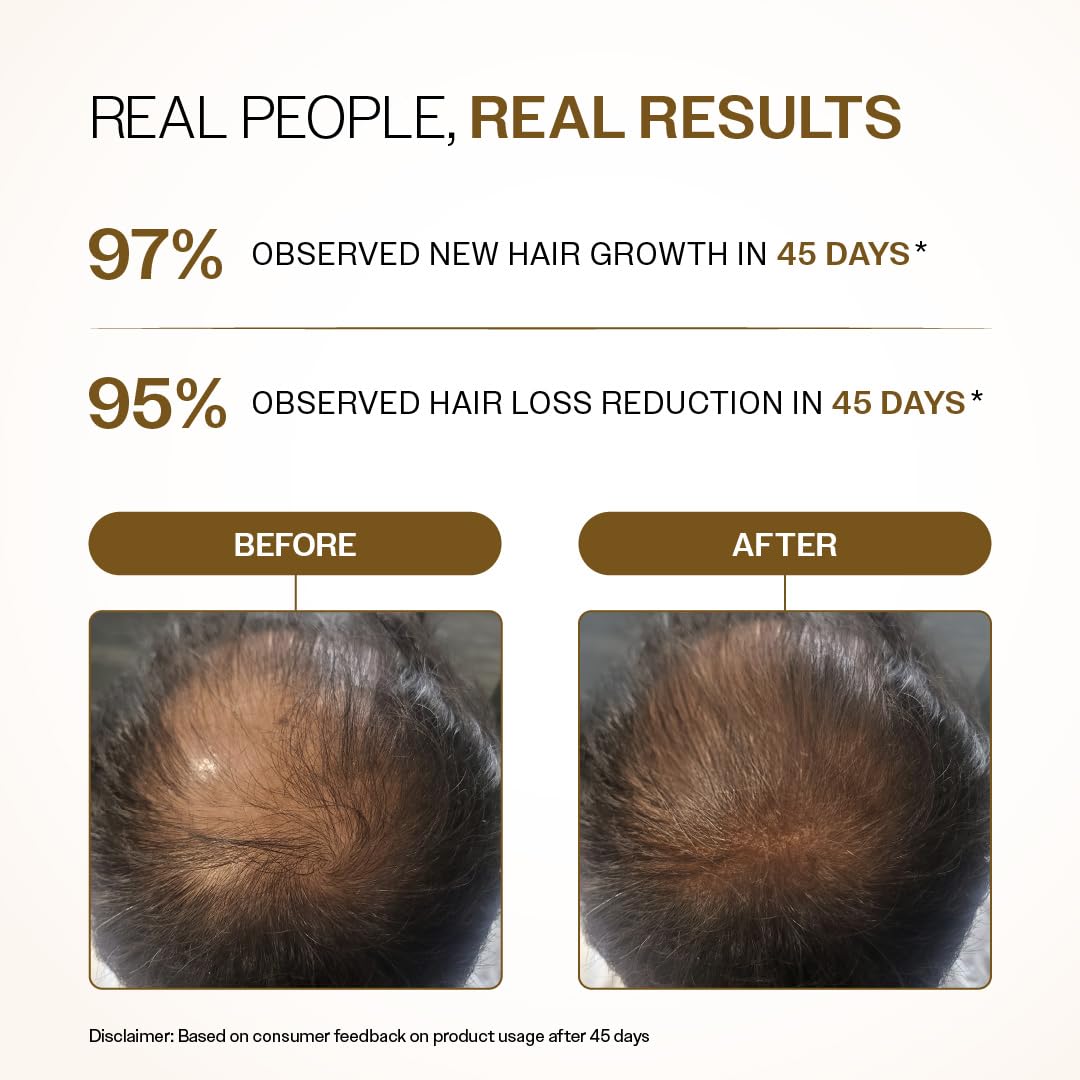Bare Anatomy Advanced Hair Growth Serum Roll-On| 3% Redensyl + 4% Anagain + 2% Baicapil + 5% Rosemary, Rice Water, Biotin & Saw Palmetto| Reduces Hair Fall, Supports Hair Growth for Men & Women | 25ml