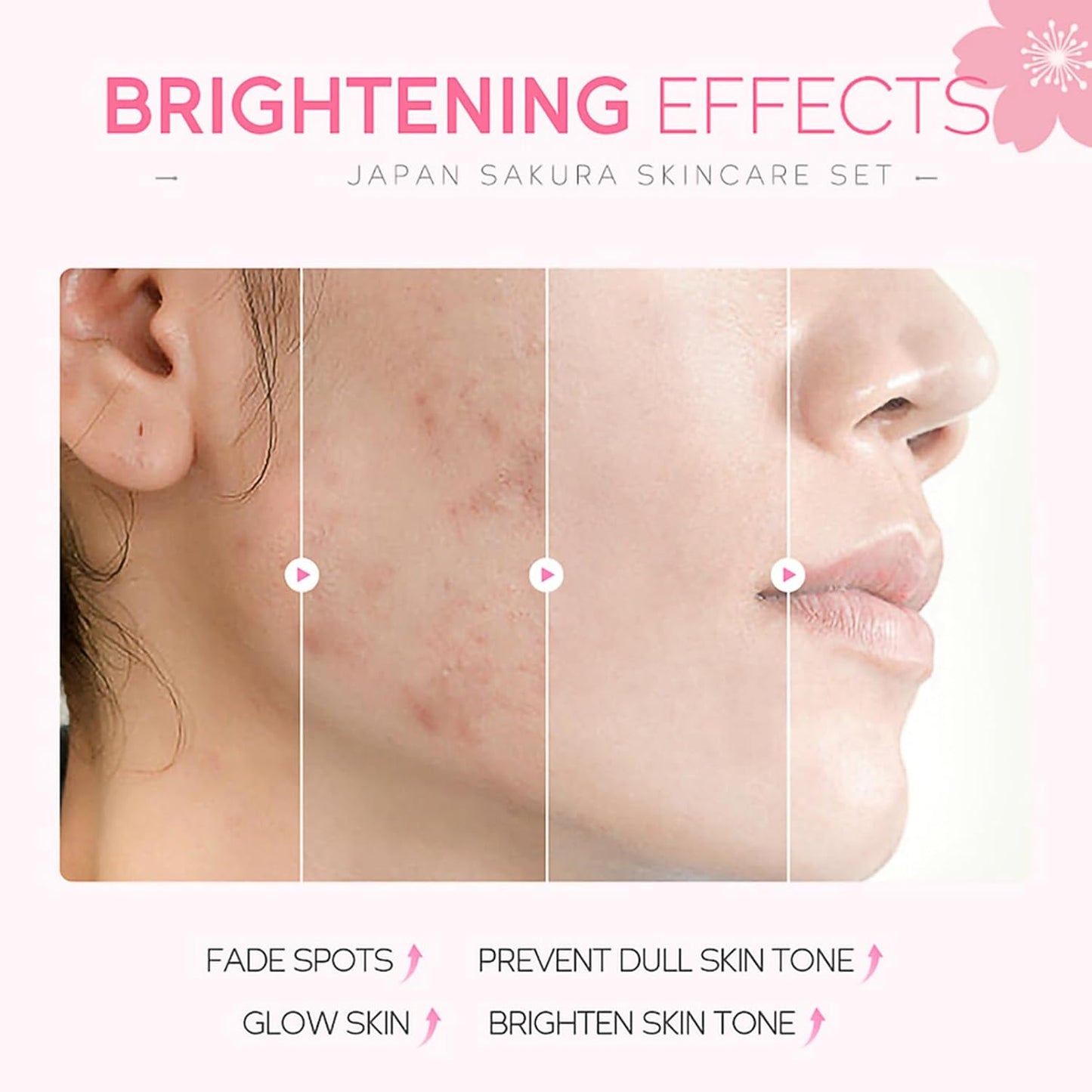 Cherry Blossom Skincare Set for Teenage Girls | Pampering Facial Kit & Gift Set - One Size