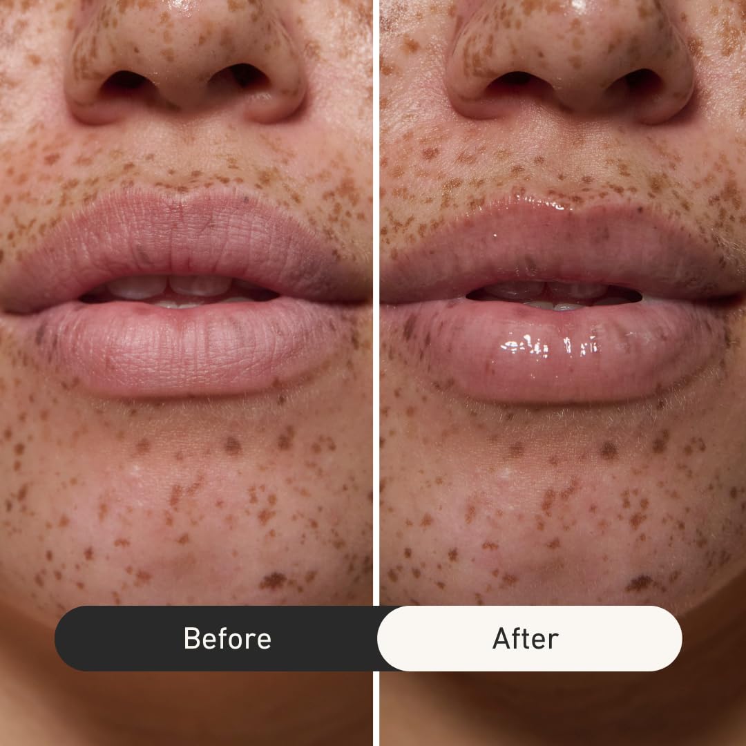 good light Multipeptide Lip Nectar. Hydrating Lip Balm & Plumping Lip Gloss Treatment. Moisturizing Lip Mask Overnight, Lip Serum with Peptides, Vitamin C, & Lychee. Vegan Korean Lip Gloss, 0.3 Fl Oz