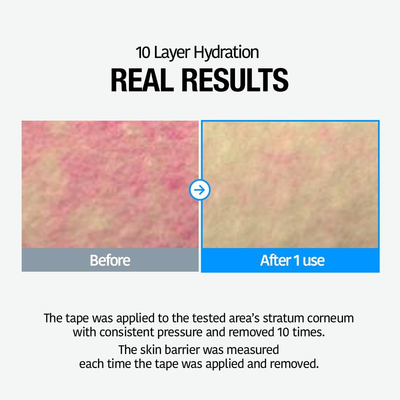 GOODAL Heartleaf Hyaluron Soothing Toner - Trouble Care, Korean Skin Care, Soothing, Moisturizing, Hydrating, Calming Skin, Instant Cooling, Hyaluronic Acid,Ceramide (11.83 fl.oz.)